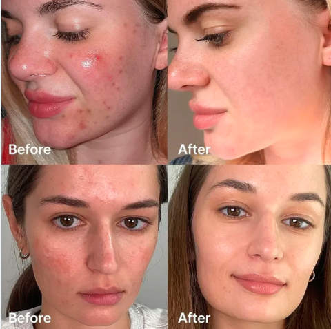 PDRN Pink Peptide Serum - 1.01 Oz