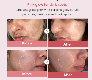 PDRN Pink Peptide Serum - 1.01 Oz